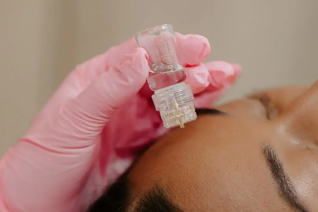 AquaGold Facial Fairfield County CT
