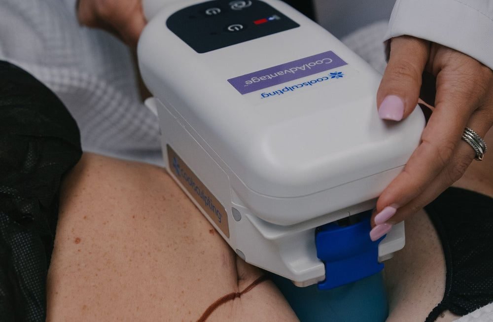 CoolSculpting in Fairfield County, CT
