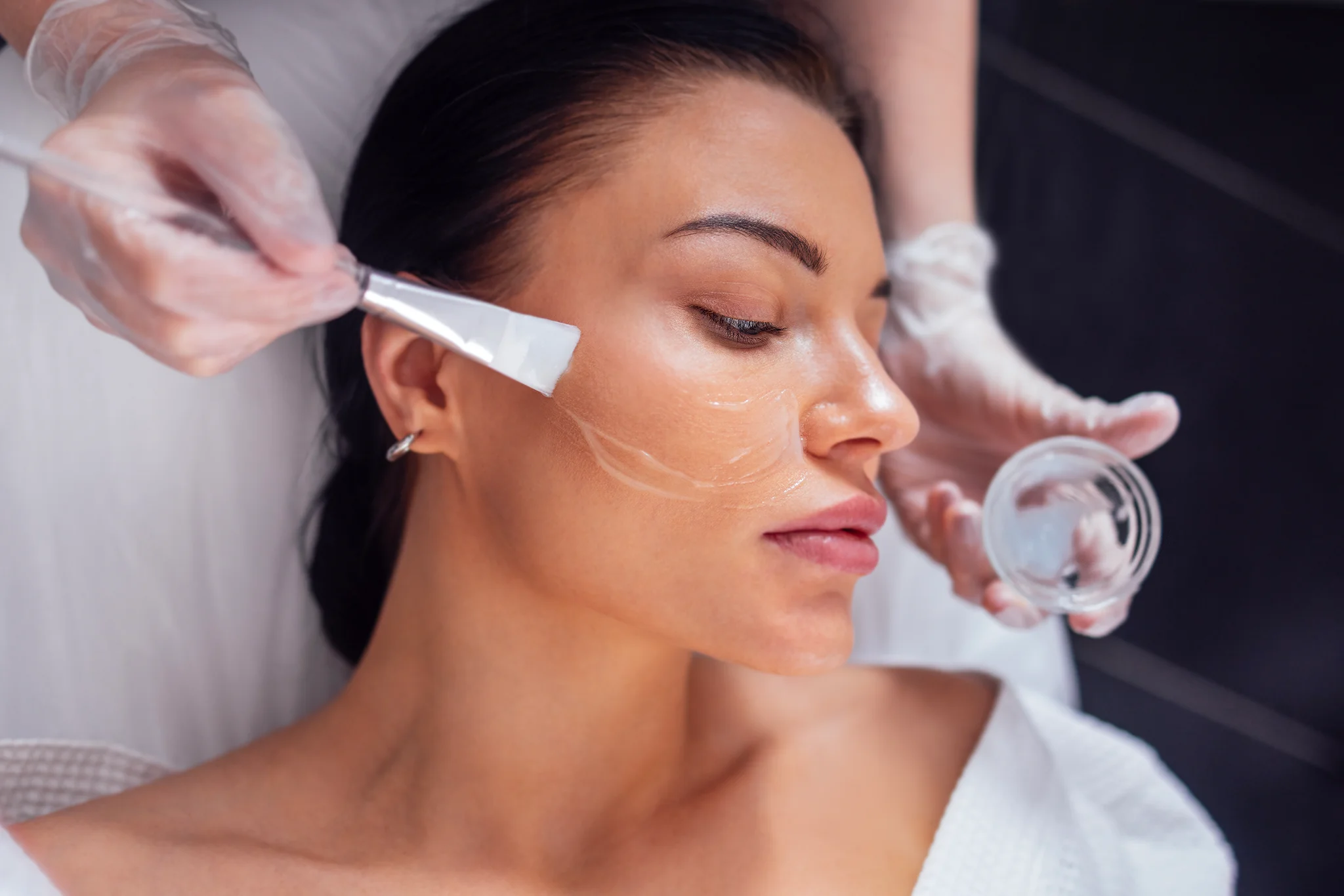 Deep Peel TCA Chemical Peel for Wrinkles & Pigmentation in Darien, CT
